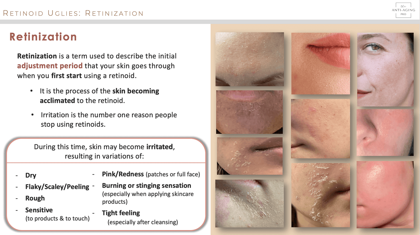What is retinization? What are retinol uglies? The adjustment period when first starting retinoids.