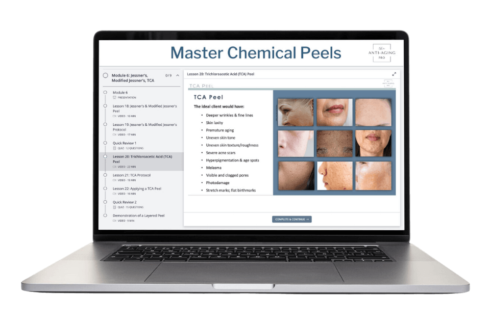 Chemical Peel Course on a laptop