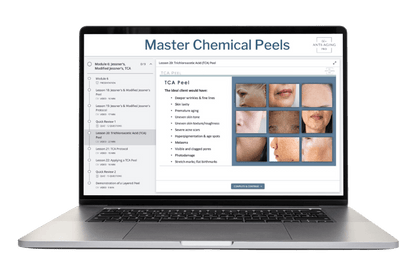 Chemical Peel Course on a laptop