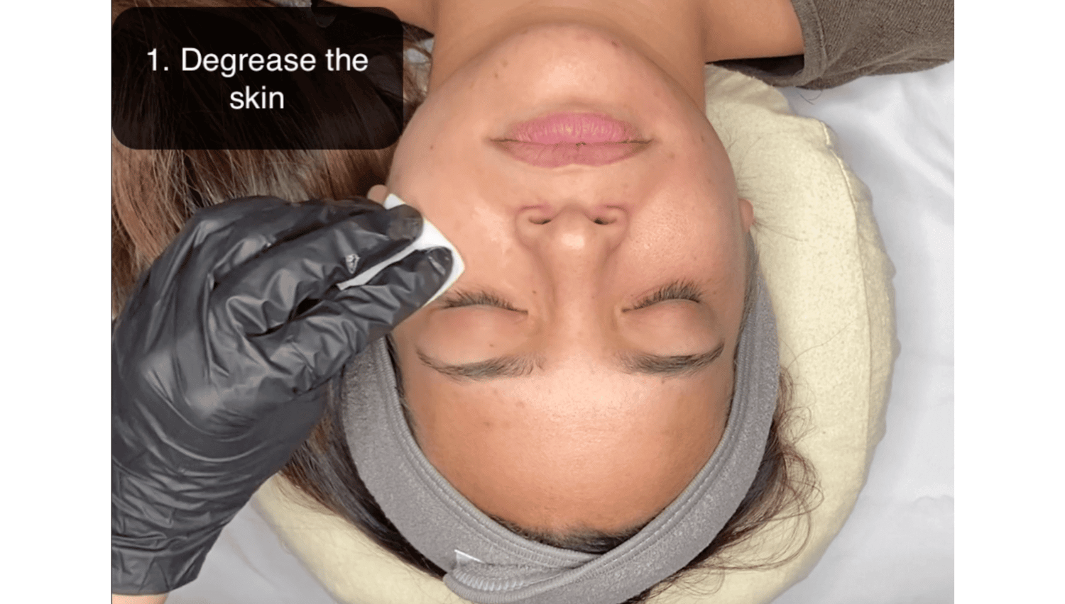 Online Chemical Peel video step-by-step demonstration degreasing the skin