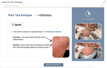 Microneedling Pen Speed