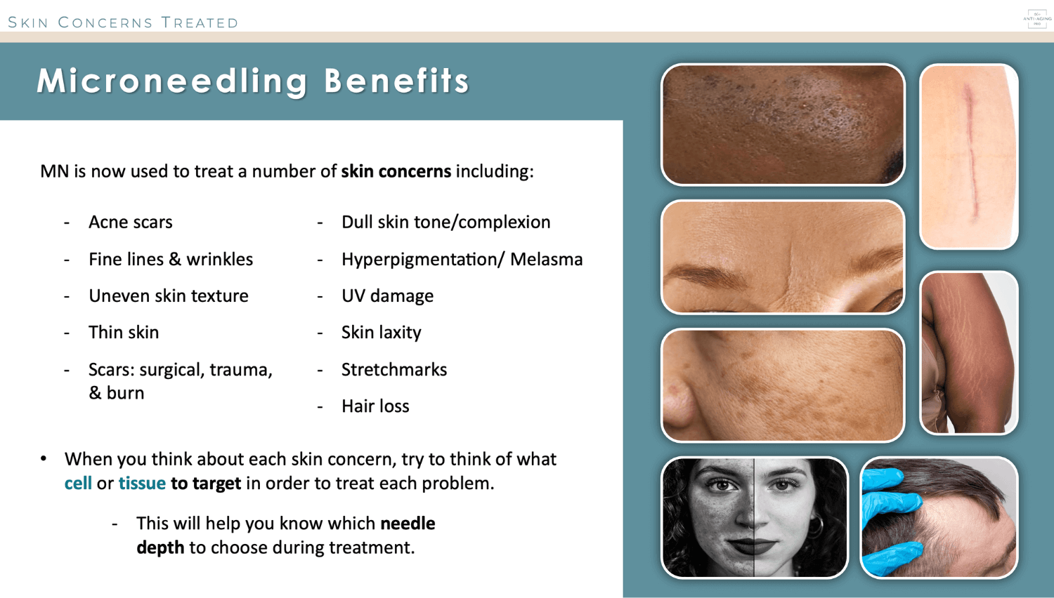 A list of microneedling benefits in the skin