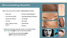 Load image into Gallery viewer, A list of microneedling benefits in the skin
