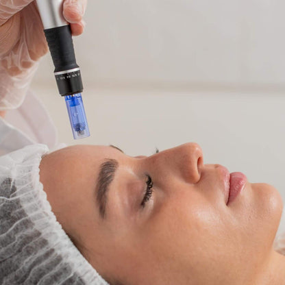 Women getting microneedling treatment