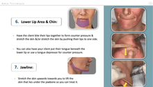 Load image into Gallery viewer, Microneedling techniques for different facial areas

