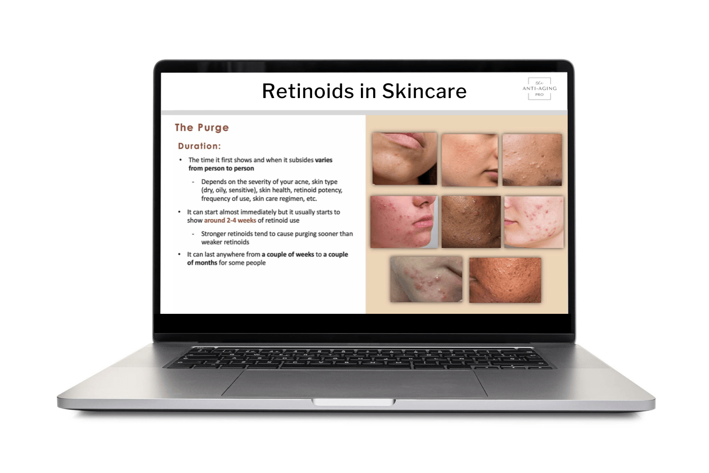 Laptop displaying a webpage about retinoids in skincare with images of skin conditions.