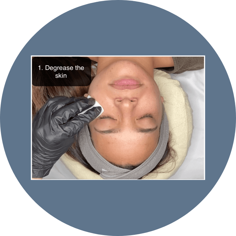 Woman receiving a chemical peel with a gloved hand applying a product.
