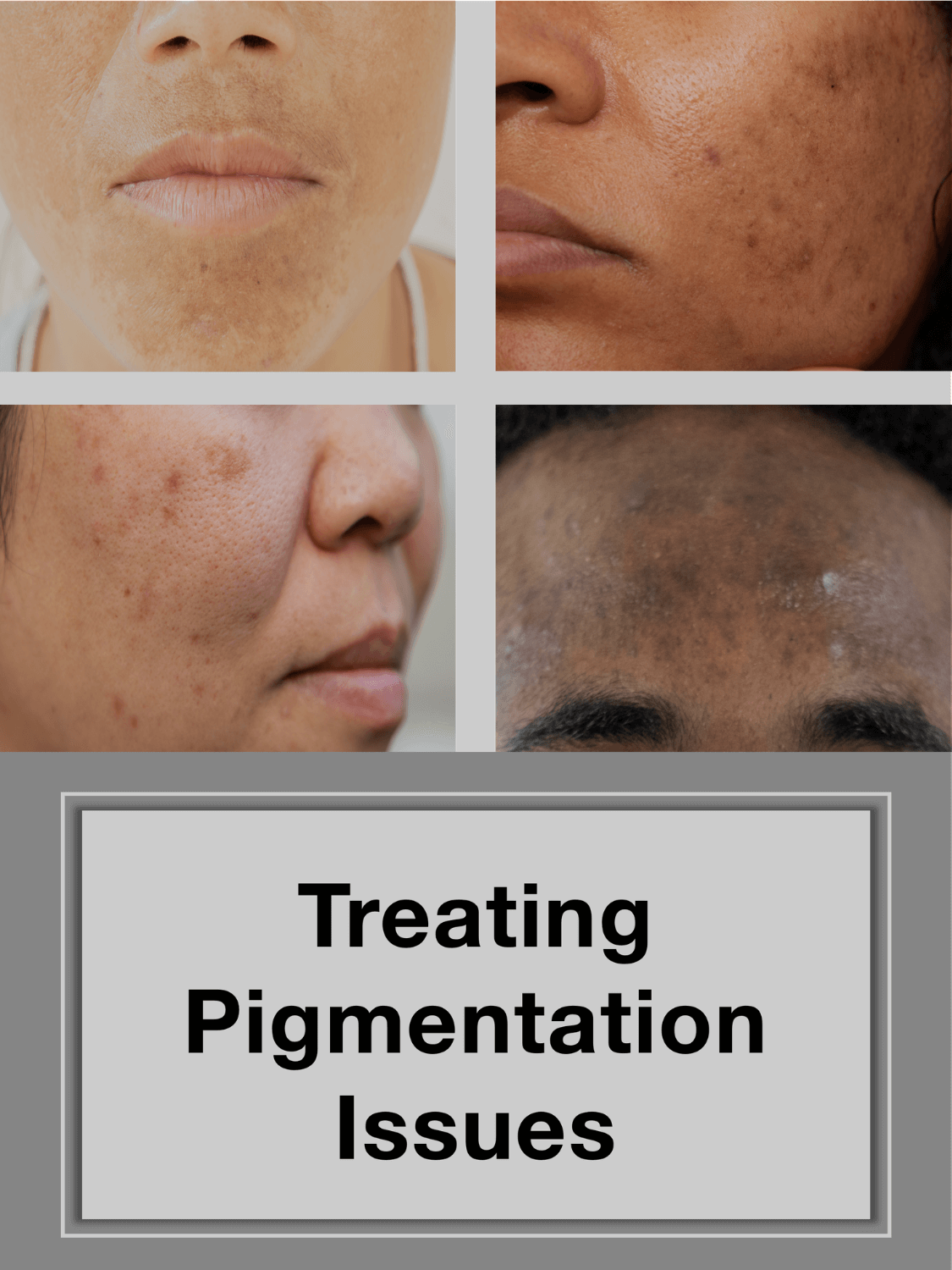 Online course cover titled "Treating Pigmentation Issues" with images of different skin pigment issues such as PIH, melasma, & hyperpigmentation 